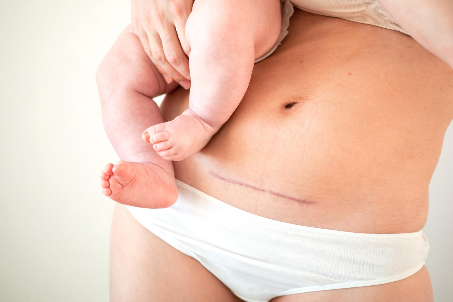 mother with c-section scar and her baby