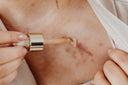 scar cream