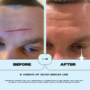 SILICONE SCAR SERUM - 10mL